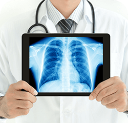 Lead Shielding Physicist Report Anode Imaging - Space Art Collection - High Resolution Quality